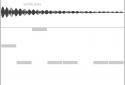 Nanoloop screenshot 11